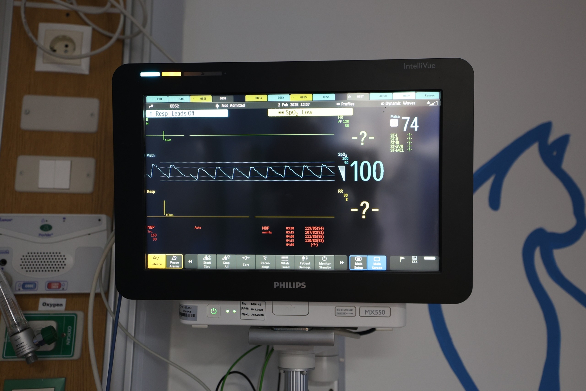 نظام المراقبة الفسيولوجية