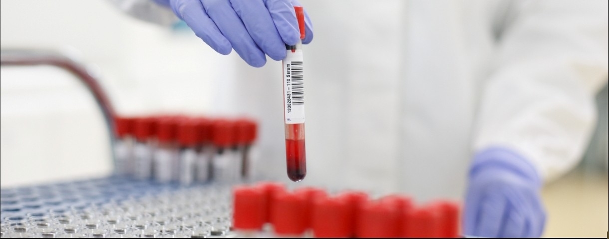 Procleix ULTRIO Elite Assay